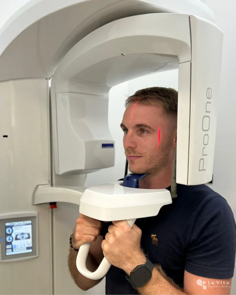 Ortopan – panoramska RTG dijagnostika Zatvaranje kirurške rane šavovima u usnoj šupljini.