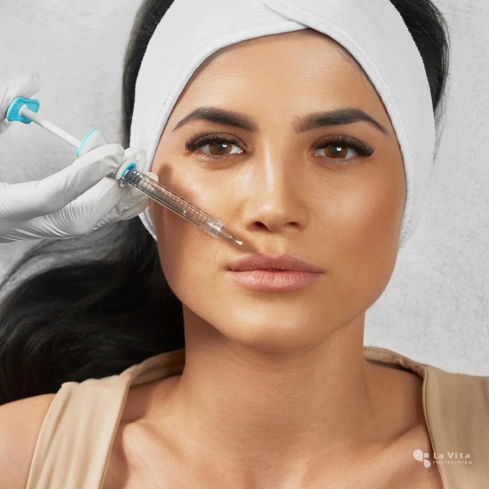 Dermalni fileri – precizna i kontrolirana aplikacija tretman botulinum toksinom za smanjenje mimičkih bora
