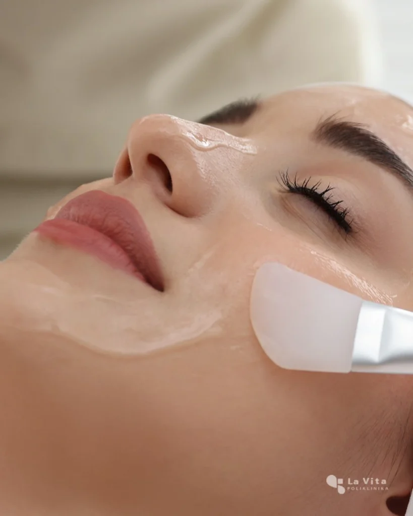 kemijski_piling_lica kemijski piling za obnovu kože i ujednačen ten.