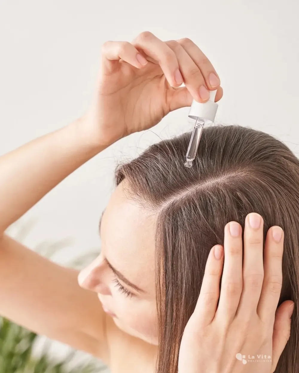 Uklanjanje kožne promjene krioterapijom.